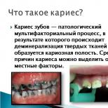 Карієс зубів - причини, симптоми, лікування і профілактика карієсу
