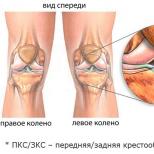 Секрети будови колінного суглоба