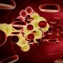 Siguranța colesterolului din sânge